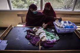 Nhân viên y tế điều trị cho em nhỏ bị suy dinh dưỡng tại bệnh viện ở Mogadishu, Somalia. (Ảnh: AFP/TTXVN)