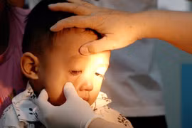 Sở Y tế Thành phố Hồ Chí Minh: Không thiếu thuốc điều trị đau mắt đỏ