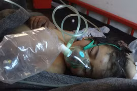 Nạn nhân một vụ tấn công hóa học tại Syria. (Ảnh: AFP)