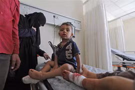 Trẻ em bị thương do trúng đạn pháo được điều trị tại bệnh viện ở Al-Bab, tỉnh Aleppo, Syria. (Ảnh: AFP/TTXVN)
