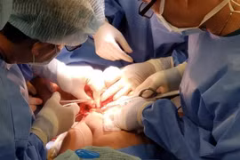 Các bác sỹ đang phẫu thuật tách rời hai bệnh nhi song sinh dính nhau. (Ảnh: TTXVN phát)