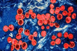 Hình ảnh virus đậu mùa khỉ dưới kính hiển vi. (Ảnh: Getty Images/TTXVN)