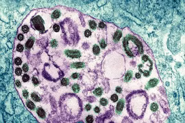 Virus Marburg khiến nhiều người ở Guinea Xích đạo tử vong. (Nguồn: Getty Images)