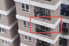 Hình ảnh phim chụp bé bị trật khớp háng bên phải. (Ảnh: BVCC)