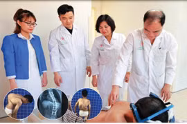 Phẫu thuật lấy lại hình dạng cho bệnh nhân gù vẹo cột sống đặc biệt