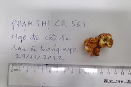 Mẫu bỏng ngô bệnh nhân đã sử dụng do gia đình cung cấp. (Ảnh: PV/Vietnam+)