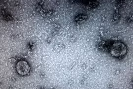 Virus corona chủng mới được Viện Vệ sinh dịch tễ trung ương nuôi cấy và phân lập thành công. (Ảnh: PV/Vietnam+)