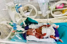 Bé An Chi trong thời gian nằm lồng ấp, chỉ nhỏ xíu như chú chuột Hamster, xung quanh là máy móc, dây chuyền chằng chịt. (Ảnh: PV/Vietnam+)