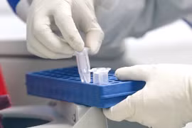 Xét nghiệm virus corona chủng mới. (Ảnh: THX/TTXVN)