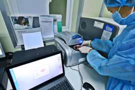 Mẫu xét nghiệm được xếp vào khay trước khi cho vào chạy máy để ra kết quả. (Ảnh: Minh Quyết/TTXVN)