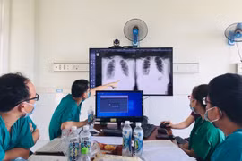 Các bác sỹ hội chẩn cho một trường hợp mắc bệnh COVID-19. (Ảnh: PV/Vietnam+)