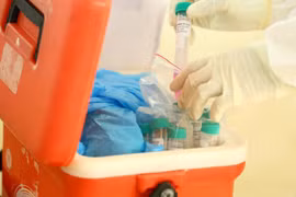 Các mẫu bệnh phẩm chuyển đến các đơn vị xét nghiệm bằng phương pháp RT-PCR. (Ảnh: Minh Quyết/TTXVN)