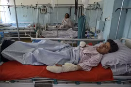 Nạn nhân bị thương trong vụ tấn công nhằm vào đám cưới ở Kabul, Afghanistan được điều trị tại một bệnh viện. (Ảnh: AFP/TTXVN)