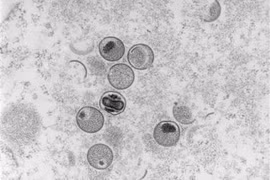 Hình ảnh virus đậu mùa khỉ dưới kính hiển vi. (Ảnh: AFP/TTXVN)