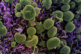 Virus SARS-CoV-2 (màu tím) trong tế bào (màu xanh) của bệnh nhân COVID-19. (Ảnh: AFP/TTXVN)