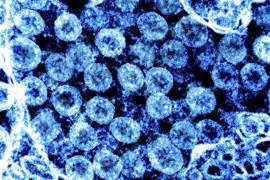 Phần tử virus SARS-CoV-2 trong mẫu bệnh phẩm của bệnh nhân mắc COVID-19. (Ảnh: AFP/TTXVN)