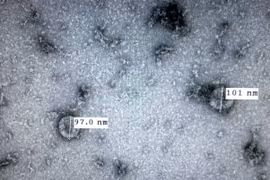 Chủng virus corona mới (nCoV) được Viện vệ sinh dịch tễ Trung ương nuôi cấy và phân lập thành công. (Ảnh: TTXVN phát)