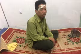 Anh Ngô Lê Nhật Tiến, Trạm phó Trạm Kiểm lâm số 7 bị đối tượng dùng gậy đánh vào vùng mặt, được điều trị tại Trung tâm Y tế huyện Ea Súp. (Ảnh: TTXVN)