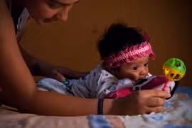 Em bé bị mắc chứng đầu nhỏ tại thủ đô Quito, Ecuador. (Nguồn: THX/TTXVN) 