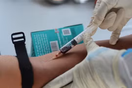 ​Lấy mẫu xét nghiệm COVID-19 bằng phương pháp là huyết thanh học (ELISA). (Ảnh: Văn Dũng/TTXVN) 