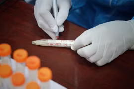Lấy mẫu xét nghiệm người dân thôn Cầu, xã Tự Lan, huyện Việt Yên (Bắc Giang). (Ảnh: Danh Lam/TTXVN)