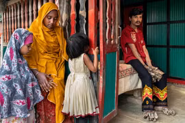 Người cây Bangladesh: 'Án chung thân' trong 'nhà tù cơ thể'