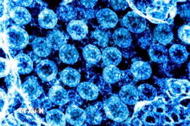 Virus SARS-CoV-2 trong mẫu bệnh phẩm của bệnh nhân mắc COVID-19. (Ảnh: AFP/TTXVN)