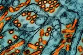 Các hạt virus cúm gia cầm H5N1 (màu cam) dưới kính hiển vi. (Nguồn: Statnews)