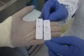 Pháp chế tạo thiết bị phát hiện virus Ebola trong vòng 15 phút