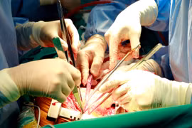 Ca ghép 2 lá phổi cho bệnh nhân tại bệnh viện Trung ương Quân đội 108. (Ảnh: Tư liệu bệnh viện/TTXVN phát)
