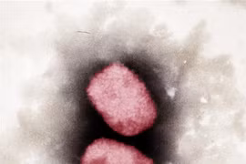 Virus gây bệnh đậu mùa khỉ (ảnh chụp qua kính hiển vi) tại Viện nghiên cứu Robert Koch, Đức. (Ảnh: AFP/TTXVN)