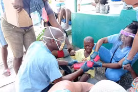 Các bác sỹ Cuba chữa trị cho một em bé bị thương trong trận động đất ở Les Cayes (Haiti), ngày 14/8/2021. (Ảnh: THX/TTXVN)