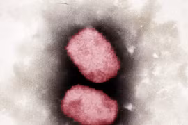 Virus đậu mùa khỉ nhìn dưới kính hiển vi. (Ảnh: AFP/TTXVN)