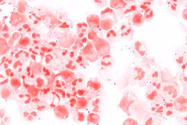 Vi khuẩn Neisseria meningitidis. (Nguồn: Wikipedia)