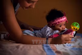 Một em bé bị mắc chứng đầu nhỏ tại thủ đô Quito, Ecuador, ngày 27/2. (Nguồn: THX/TTXVN)