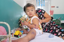Một bệnh nhi mắc tay chân miệng được điều trị tại Bệnh viện Nhi đồng 2. (Ảnh: Đinh Hằng/TTXVN)