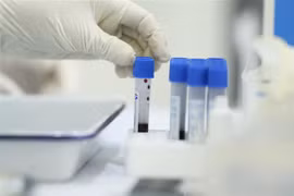 Mẫu xét nghiệm nhanh tại phường Bách Khoa và phường Cầu Dền (quận Hai Bà Trưng), sáng 1/8/2020. (Ảnh: Minh Quyết/TTXVN)