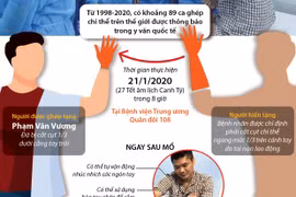 Thực hiện thành công ca ghép chi thể lấy từ người cho sống