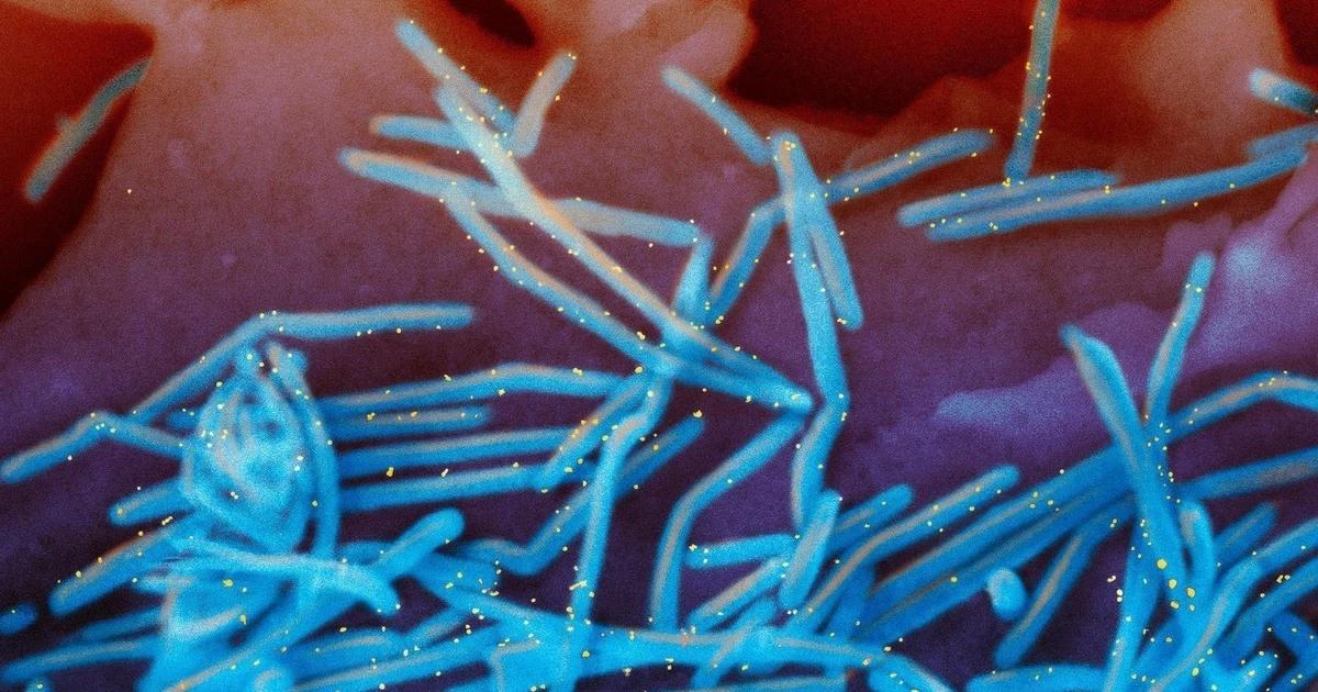 Pháp ghi nhận ca nhiễm virus hiếm gặp ở người