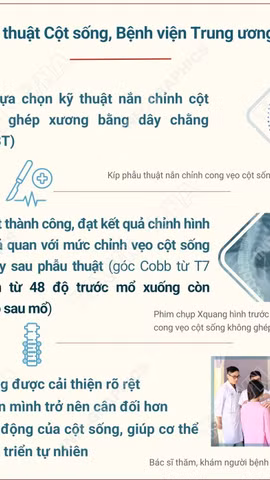Việt Nam lần đầu phẫu thuật thành công nắn chỉnh vẹo cột sống không ghép xương